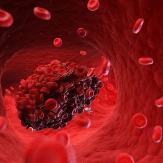 Riduce la Formazione di Coaguli di Sangue